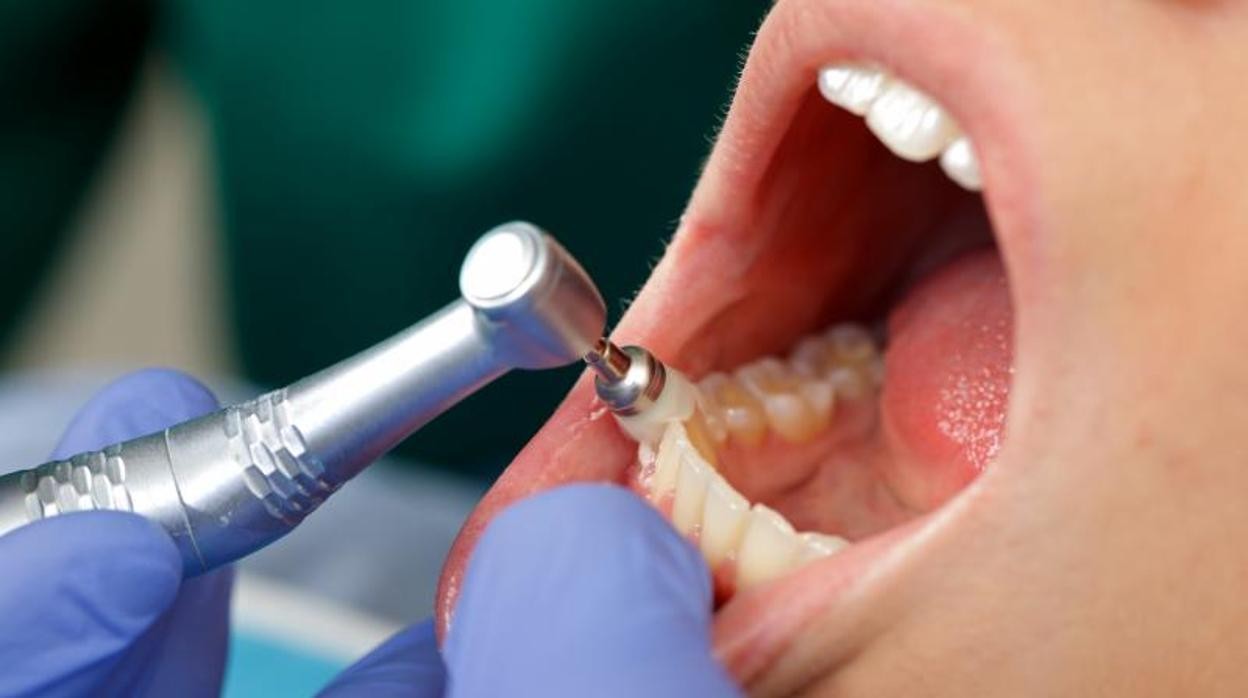 Eliminación de caries